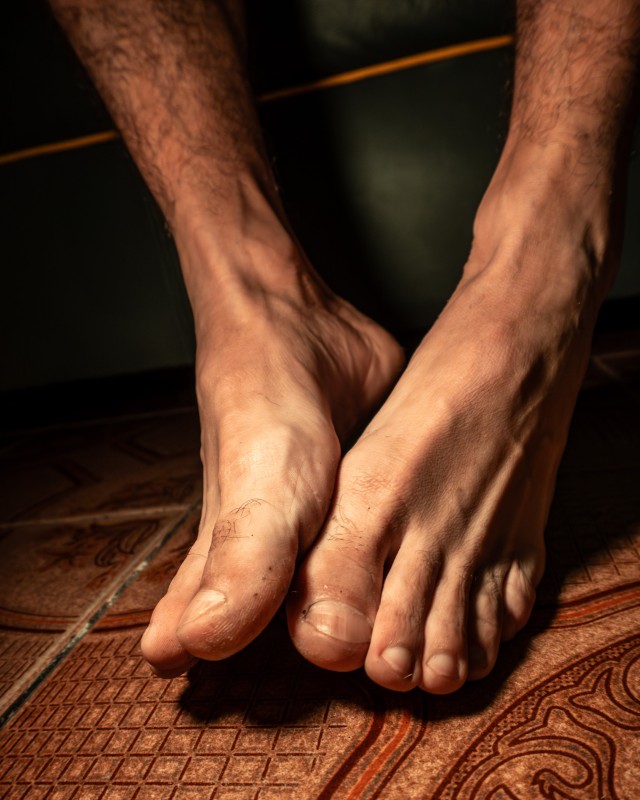 fg-76original fg-76original